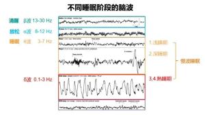 闭目养神有休息效果吗 让大脑得到一定休息