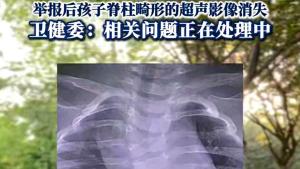 卫健委回应产检正常出生却诊出畸形 家属质疑与医学局限性解析