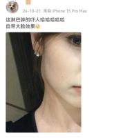 网红博主一栗小莎子发布治疗vlog 化疗日记引共鸣