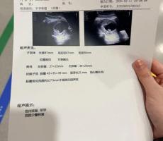 孕妇在海马体换装后摔倒致宫腔积液 强制穿搭惹争议