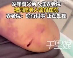 家属曝老人在养老院遭其他老人殴打：事发2小时才被发现