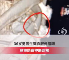 36岁男医生穿衣伸胳膊断两根肋骨 医生建议38岁之前像存钱一样存钙