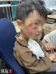 3岁男孩被狗咬伤抢救无效死亡 恶犬袭童悲剧引安全反思