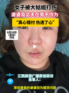 女子被大姑姐打伤婆婆及丈夫在旁不作为