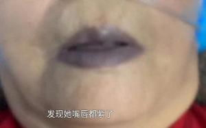 老人吃去年腌的萝卜后中毒入院 腌菜安全需警惕