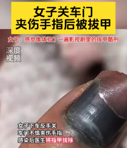 越来越爱上和陌生人出行！女子反手关车门失误后体验拔甲酷刑