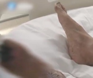 男子吸煙40多年5個腳趾全壞死,，繼續(xù)抽煙另一條腿也難保,！
