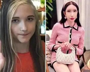 女網(wǎng)紅想變韓女全臉整容對標張元英 追夢還是跟風？