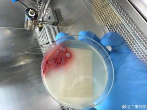 夫妻吃了竹鼠后雙雙確診肺炎 拒食野味是預(yù)防關(guān)鍵