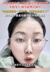 36歲寶媽生完二胎后患上嚴(yán)重牙周??！