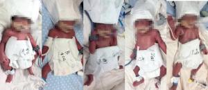 1男4女5胞胎出生画面让人动容 生命奇迹温暖人心