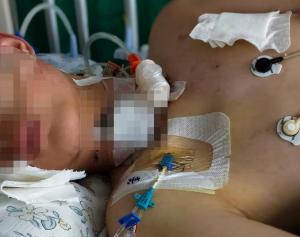 被绳割断气管男孩从ICU转出 家属陪伴期待康复