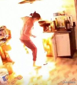 长期关气不关灶老人大面积烧伤 固执习惯埋下致命隐患