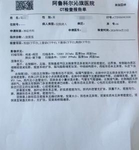 养老院老人被85岁室友打骨折 护工监护缺失引争议