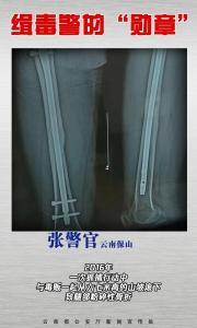 媒体：缉毒警察的伤疤是摘不掉的勋章 无言荣光