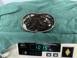 一男子胃中取出180颗铁钉 医生精准手术解危