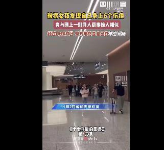 女孩身上6个伤疤同寻人启事一致 失散17年与家人相聚