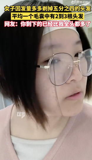女子因發(fā)量太多剃掉五分之四頭發(fā)，網(wǎng)友：你剩下的已經(jīng)比我全頭都多了,！