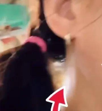 陳意涵醫(yī)美后臉歪了