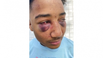 Grand jury indicts 2 officers fired for beating Black teen
