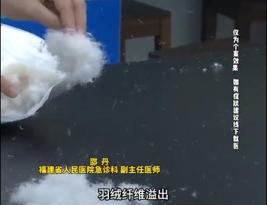 羽绒服“漏绒”致呼吸衰竭！医生：警惕“羽绒肺” 长期穿着破损羽绒服风险大