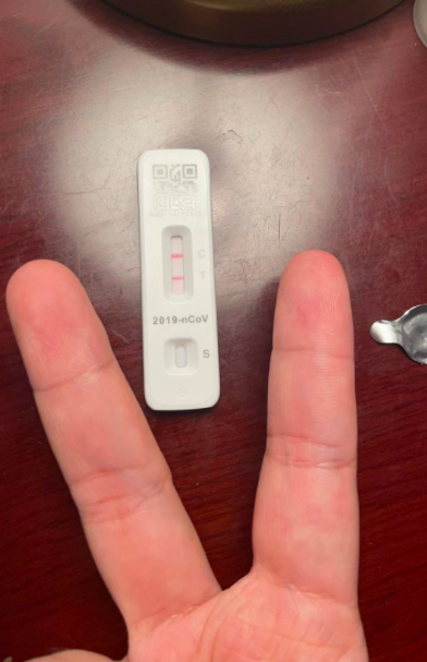 阳了之后没味觉是什么体验？味觉失灵特别影响食欲
