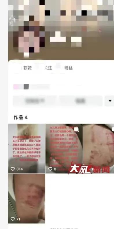 男子打19岁女儿致耳穿孔：留宿女同事家遭父亲怀疑谈恋爱 母亲网上发声