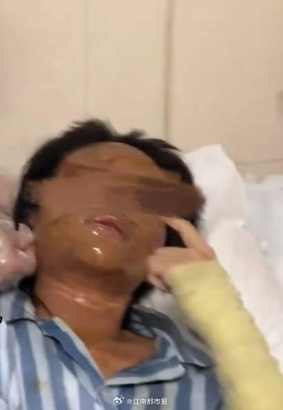 当地公安回应主播收到炸弹包裹被炸伤