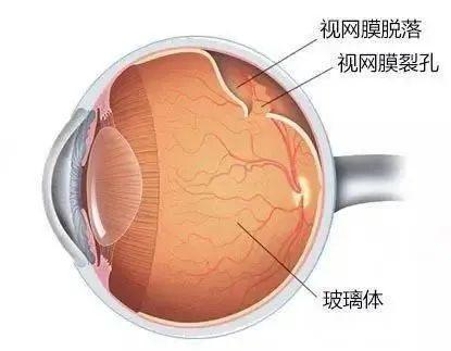 体验跳水视网膜脱离 揭秘跳水运动员“职业病”