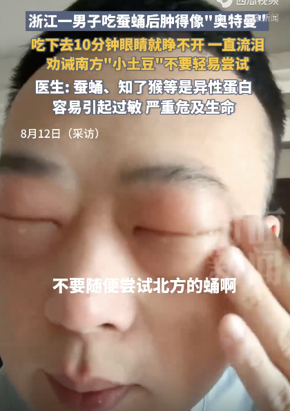 一直流泪 男子吃蚕蛹后肿得像“奥特曼” 奇异反应引热议