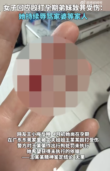 女子回应咬伤孕期弟妹