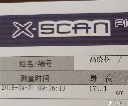 51岁高晓松近照瘦太多 穿紧身裤秀出一双筷子腿