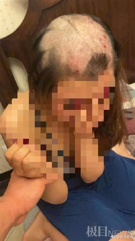 警方通报女子被丈夫剃光头拍照发网上 男子已被行拘