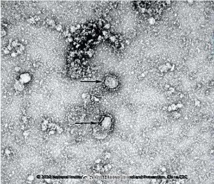 研究人员发现冠状病毒致命弱点，新冠病毒或有“特效药”？