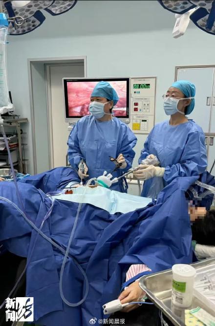上海女子体内取出50颗子宫肌瘤 罕见病例引发关注