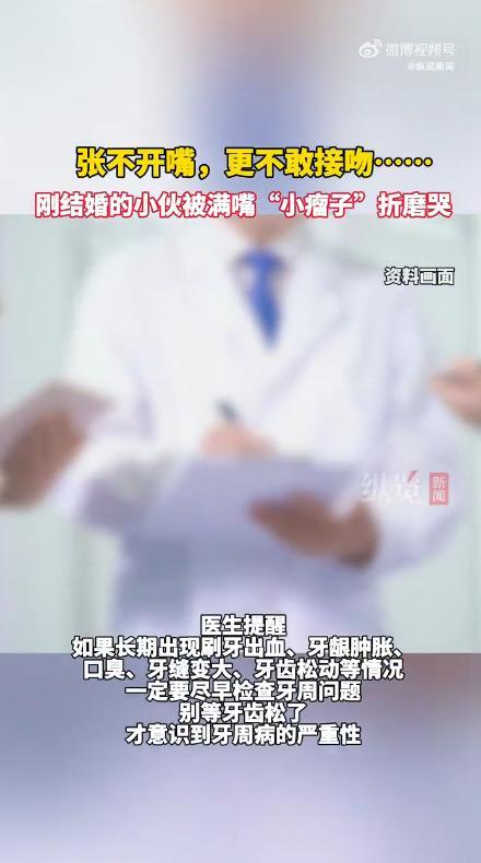 小伙新婚满嘴“小瘤子”不敢接吻 牙周炎惹的祸