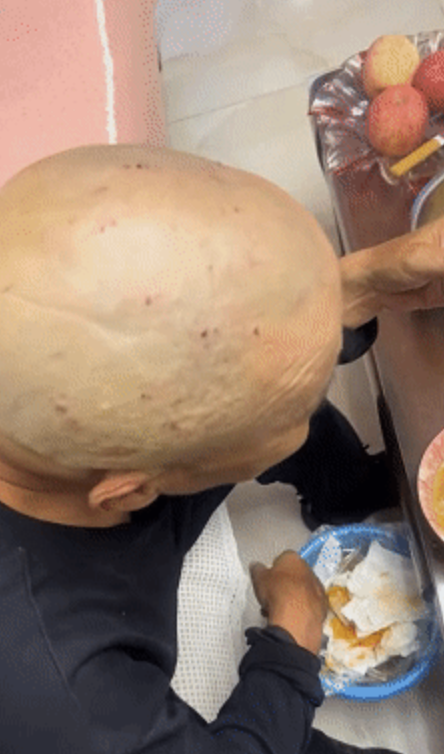 女儿回应老人花10元剃头满头血痂 父亲隐忍引发关注