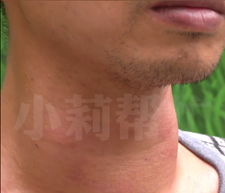 男子1天吃10顿暴瘦110斤