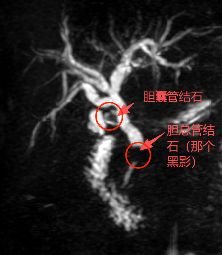 须眉得漠视病腹痛10年全身变黄 忽视小痛酿大祸
