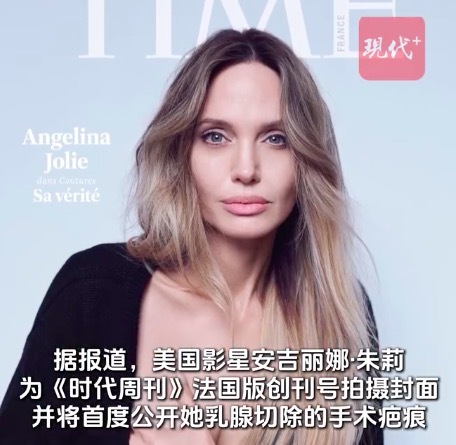 安吉丽娜朱莉时代周刊法国创刊封面 首度公开手术疤痕 