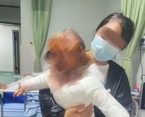 小熊回应养生壶爆炸烫伤1岁宝宝 正全力调查原因