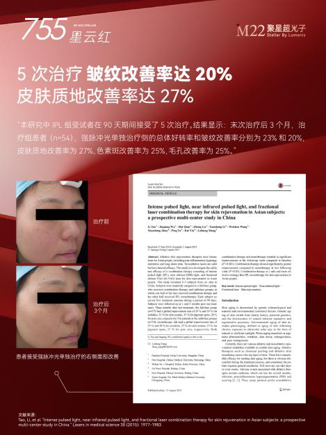 重磅引进！皖北首台！阜阳首台！超级明星设备正式落地阜阳！