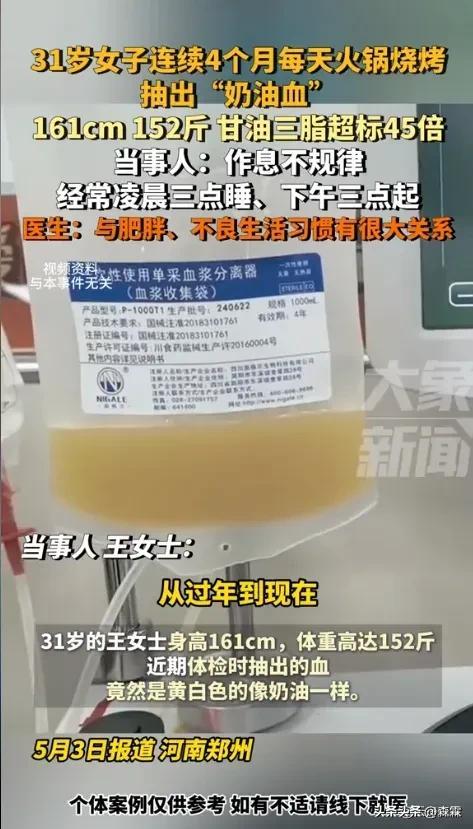 女子4個(gè)月每天燒烤火鍋抽出奶油血 不良生活習(xí)慣惹禍