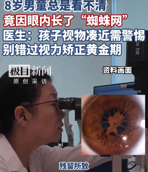 8岁男童眼内长蜘蛛网看不清 医生：孩子视物凑近需警惕，别错过视力矫正黄金期