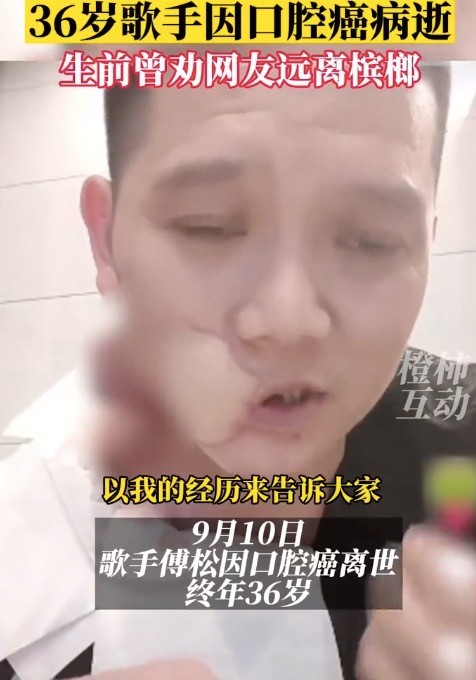 画面残忍：半边脸溃烂！36岁歌手嚼槟榔6年因口腔癌过世