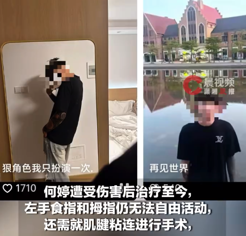 广西双胞胎一死一重伤案一审将宣判 姐姐治疗至今