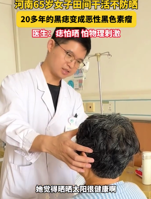 65岁农妇常年不防晒脸上黑痣癌变 医生提醒