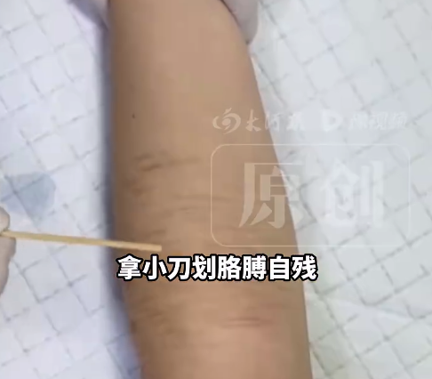 高三女生高考前表白被拒自残入院 医生判断：是失恋导致的情绪波动和自我怀疑