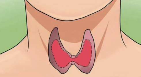 先瘦再胖是桥本甲状腺炎的常见表现!什么是桥本病