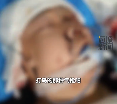 18岁少年下班途中被气枪打伤头部 家属紧急求助：寻求针对枪伤的脑科专家诊断